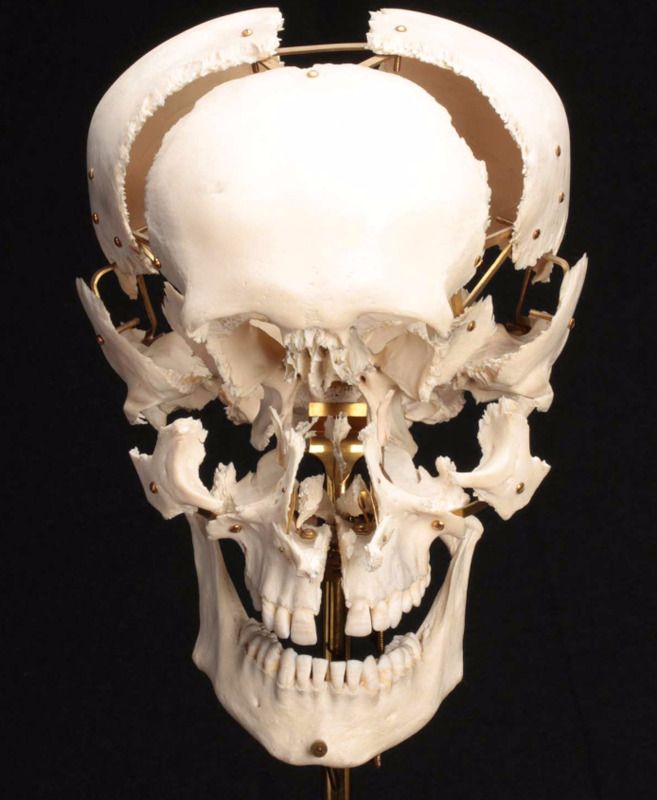 A skeleton of a human skull is shown on a black background.