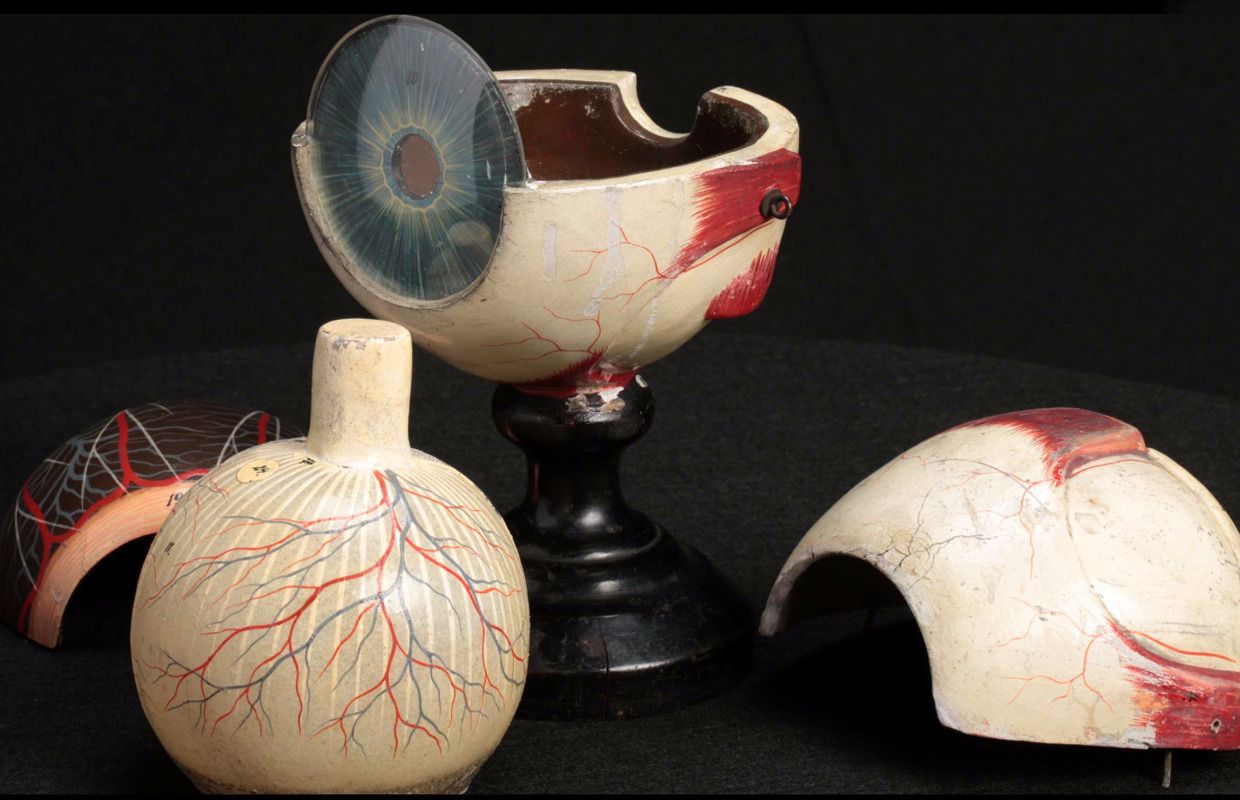 A model of an eyeball cut open and pulled apart.