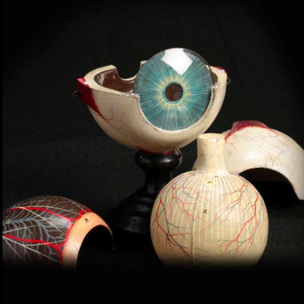 A model of an eyeball cut open and pulled apart.